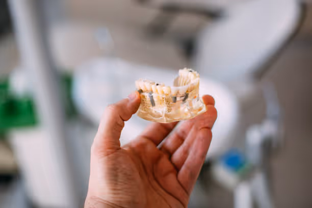 Dental Implants at Fletcher Dental Centre